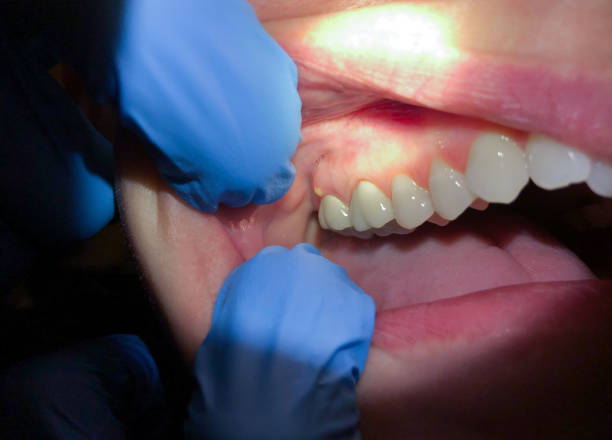 Best Emergency Orthodontic Repairs in Golden Shores, AZ