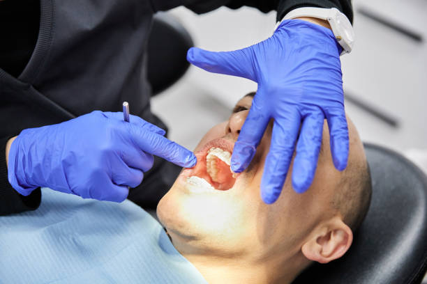 Best Dental Abscess Treatment in Golden Shores, AZ